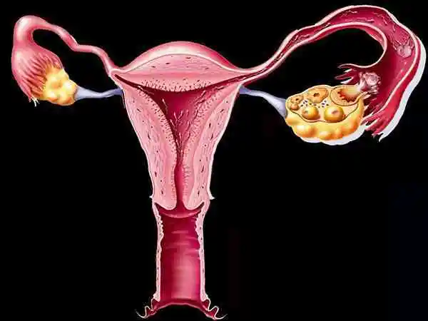 输卵管切除做试管婴儿会不会宫外孕(图1)