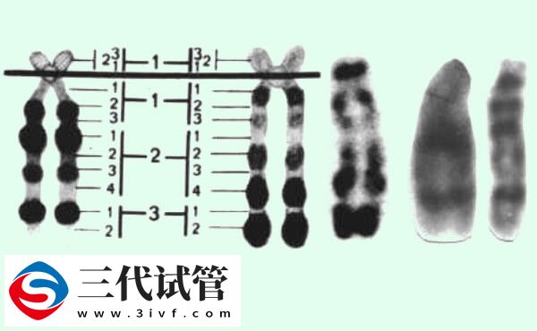 14号染色体异常能不能做三代试管(图1)