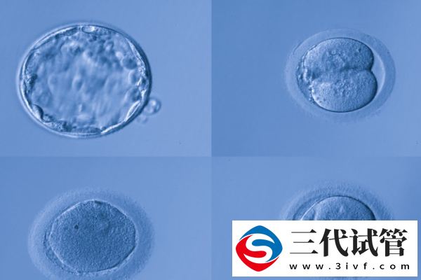 试管胚胎等级与成功率有什么关系(图1)