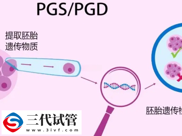 胚胎没过pgs筛查能用不(图1)