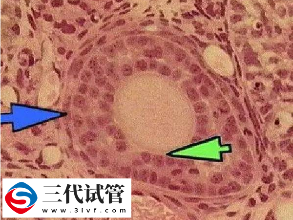 三代试管7个卵泡够用不(图2)