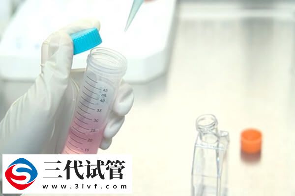 一代试管的流程是什么样(图1) 一代试管的流程是什么样(图1)