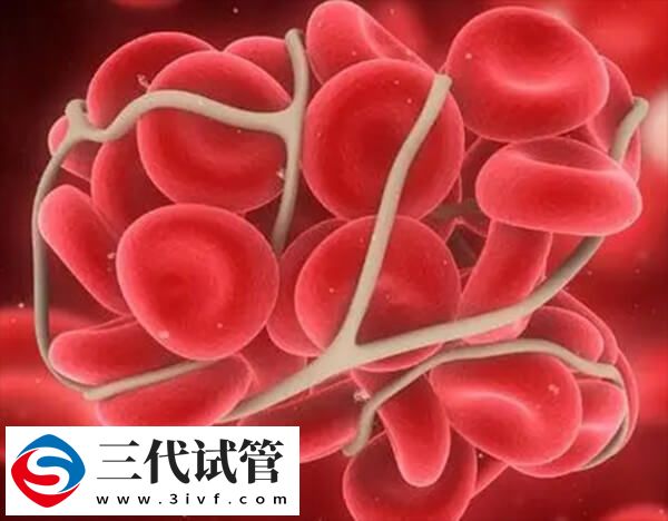 o型血为什么只能生一胎?生二胎的危险不仅只是一点(图1) o型血为什么只能生一胎?生二胎的危险不仅只是一点(图1)