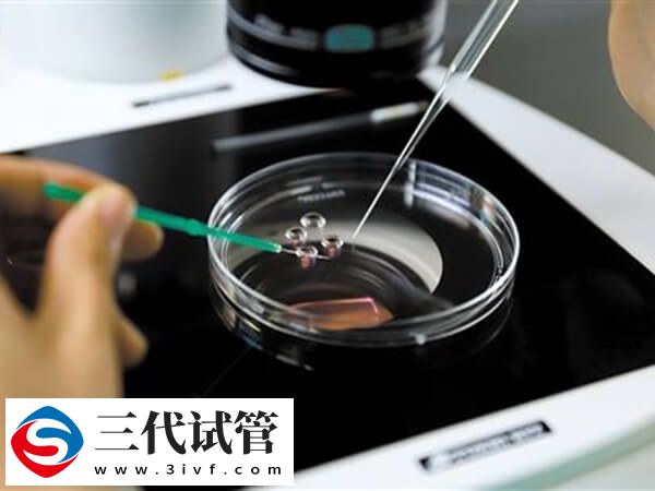 精子活力低做试管怎么办(图2)