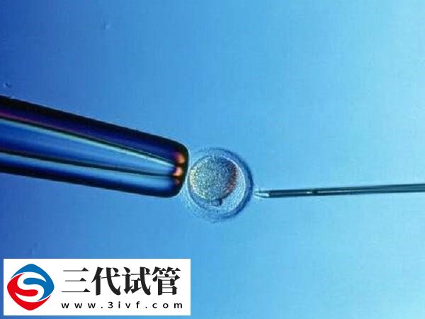 试管移植双胎着床后能不能减胎(图1) 试管移植双胎着床后能不能减胎(图1)