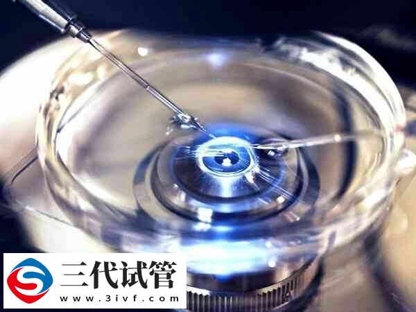 取卵后可以吃什么食物(图1) 取卵后可以吃什么食物(图1)