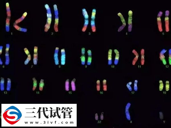 骨软骨瘤做三代试管生育有用吗?(图1) 骨软骨瘤做三代试管生育有用吗?(图1)