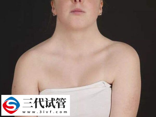 自然怀孕两次胎停都是特纳要做三代吗？(图1)