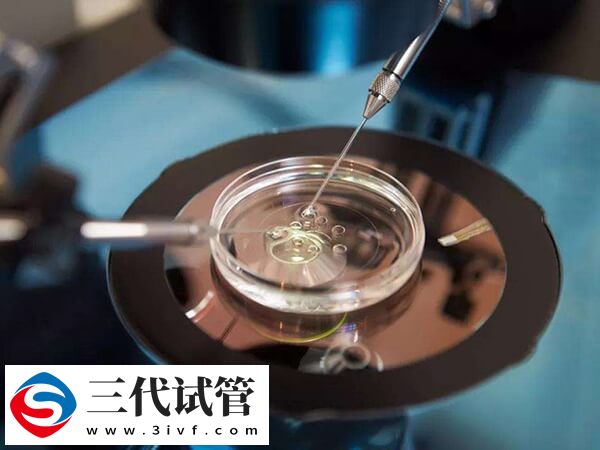 第三代试管pgt筛查后会有唐氏宝宝吗?(图1) 第三代试管pgt筛查后会有唐氏宝宝吗?(图1)