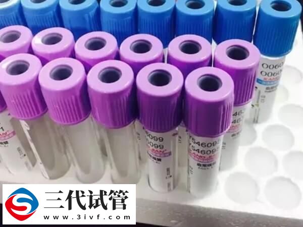 试管婴儿前期男女又方全套体检多少钱?(图1) 试管婴儿前期男女又方全套体检多少钱?(图1)