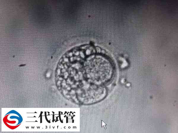 13细胞胚胎怎么样(图1)