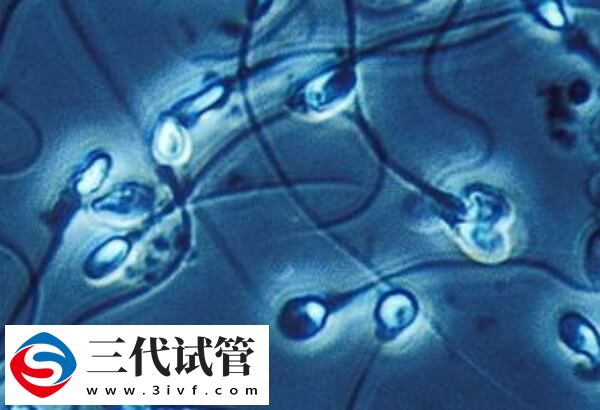 导致男性不孕不育症的原因有哪些(图2)