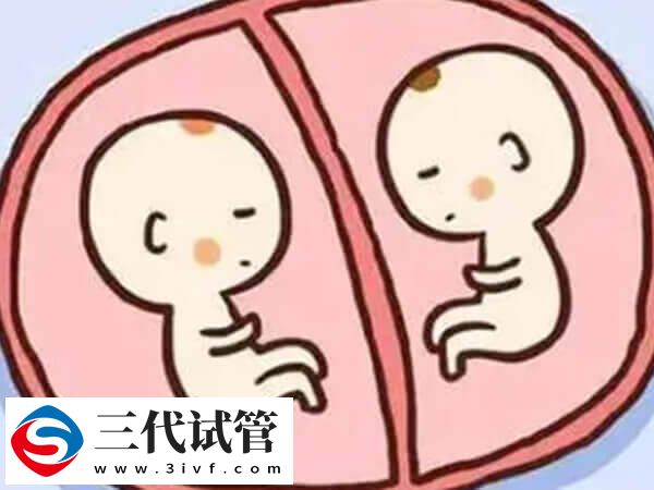 试管移植双胞胎有什么风险(图1)